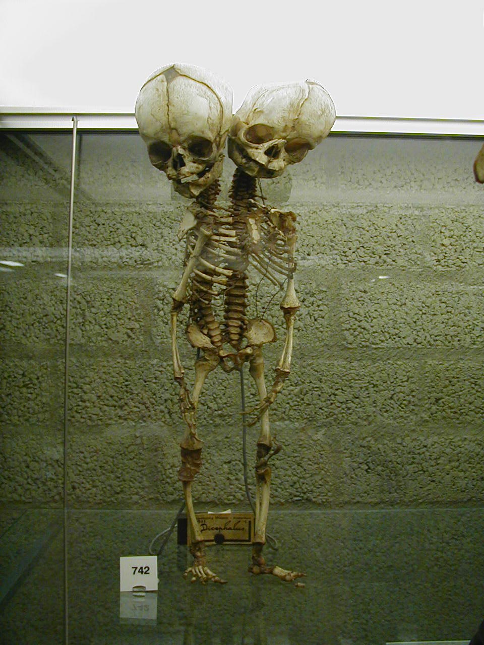Body Split Museum Graduate Art Seminar | SUNY New Paltz: art & identity | the body ...