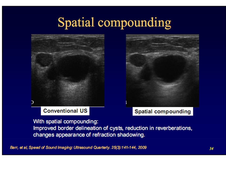 BÀI SOẠN VỀ SIÊU ÂM CHẨN ĐOÁN SIÊU ÂM ĐA HƯỚNG / Spatial Compound Sonography