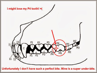 teeth diagram with labels. teeth diagram with labels. color online Teeth+diagram