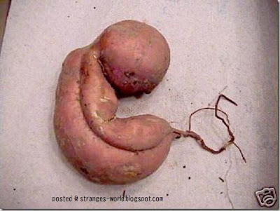 foetus_thumb.jpg
