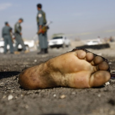 Afsprængt fod fra en selvmordsbomber i Afghanistan