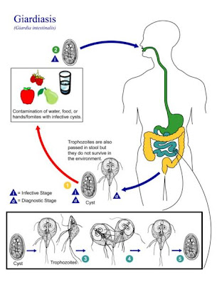 Giardia a városi vízben, Beöntés a giardia fokhagymájából