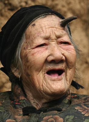 anciana-crecer-cuernos-negros-zhang-ruifang-china.jpg