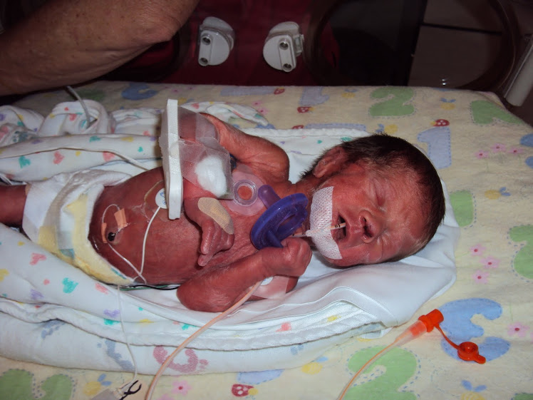 First Day of Life for Christopher