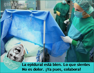 Todo sobre anestesia epidural cesárea