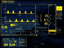 CAPNOGRAFÍA INTERPRETACIÓN (VIDEO)