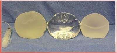 Front view standing upright Saline, Silicone Gel and Cohesive Silicone Gel