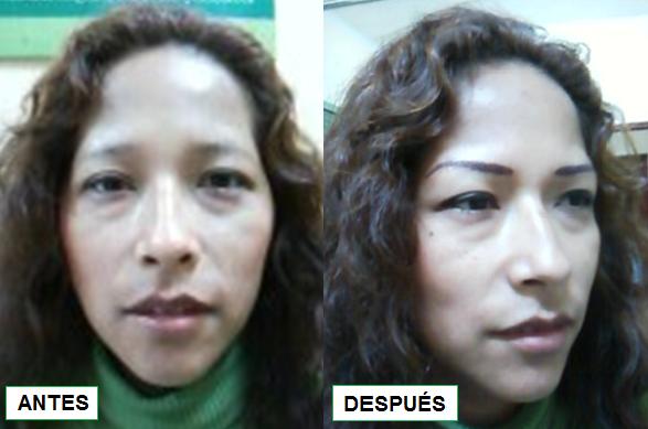 Cosmiatra Maria Esther 991666586 Maquillaje Permanente