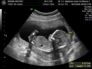 Tanner Wesley Brown 4-10-11: 15 Week Ultrasound