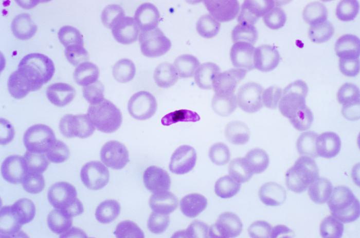 Plasmodium gametocita stádium