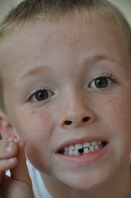 First Tooth Gone