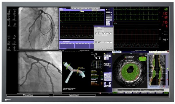 [eizo-radiforce-ls560w.jpg]