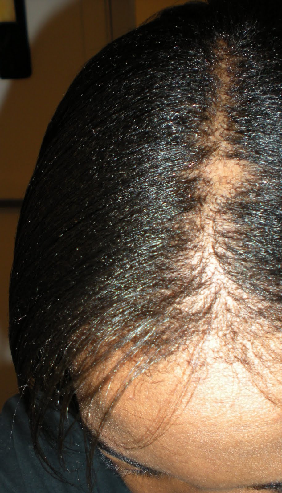 Growing my Hair..From here to there.. 12 Weeks Post Realxer Relaxer and Trim