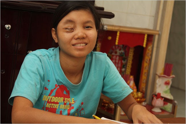 Cambodia Calling Khmer Girl s Eye Gouged Out By Brothel Owner cambodia-calling-khmer-girl-s-eye-gouged-out-by-brothel-owner