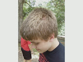 Logan Mueller's E.R. Visit!