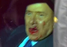 Berlusconi ferito