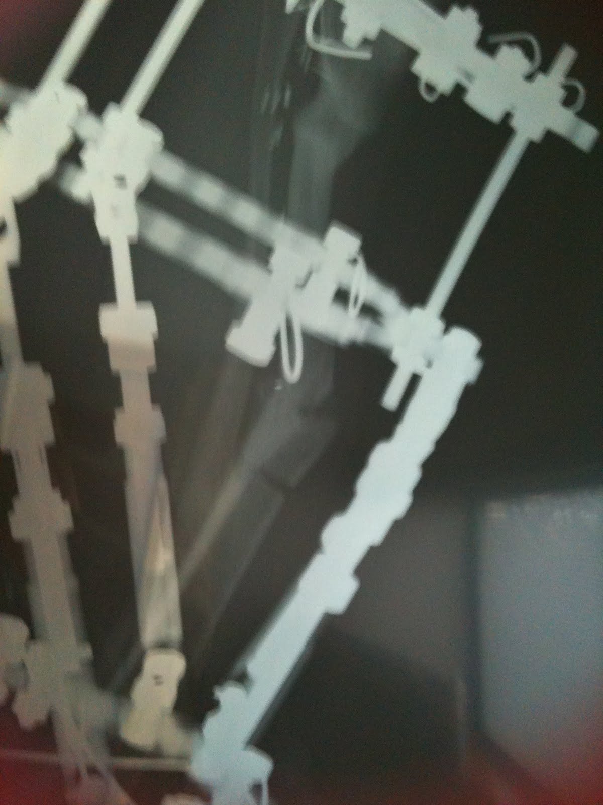 The New X-Ray