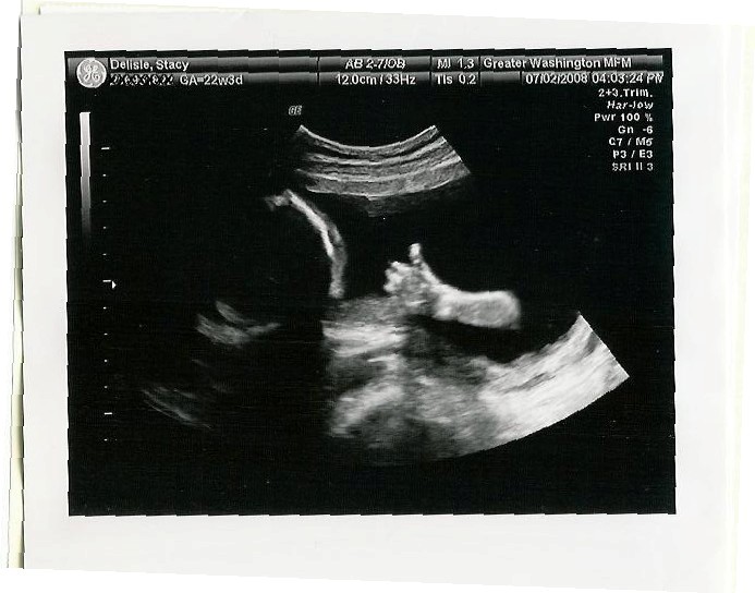 [Isaac+thumbs+up+22+weeks.jpg]