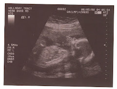 It's a girl!!!