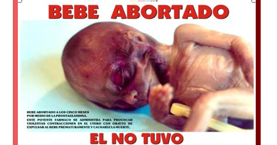 Uncion Catolica Imagen Real De Un Bebe