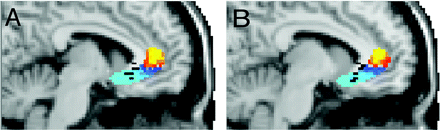 [Fig3_Johansen-Berg.gif]