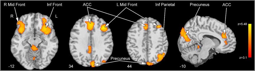 [personal+vs+control.jpg]