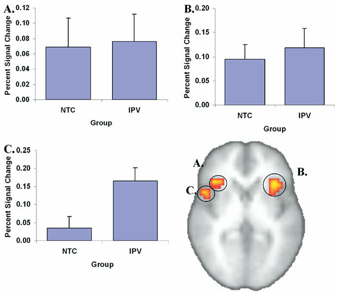 [Fig+3+-+anticipation+of+negative+images.jpg]