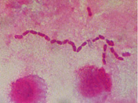  riesgo alimentario riesgo alimentario 