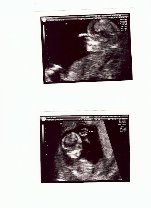 Baby Smith at 12 Weeks