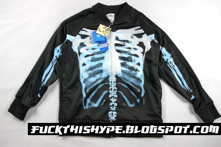 FUCK HYPE: Adidas Jeremy Scott X-Ray Track Suit (Pre-Order)