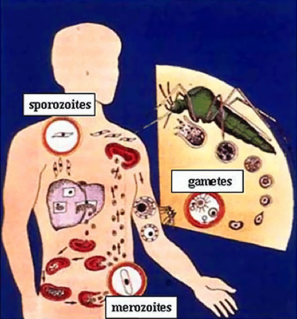 Signs Symptoms Malaria Symptoms signs-symptoms-malaria-symptoms