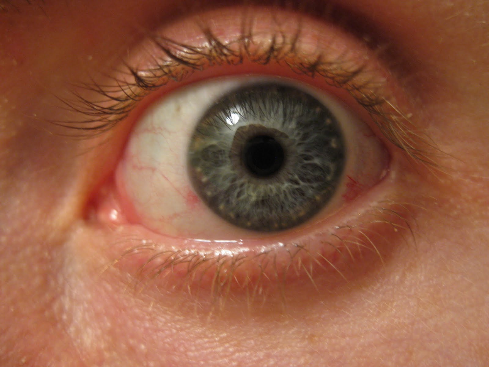 new-jock-fitness-eye-irritation-after-swimming