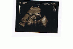 Ultrasound pix from 05/13/09 appt