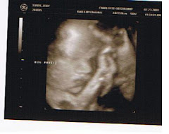 33 weeks -3D ultrasound