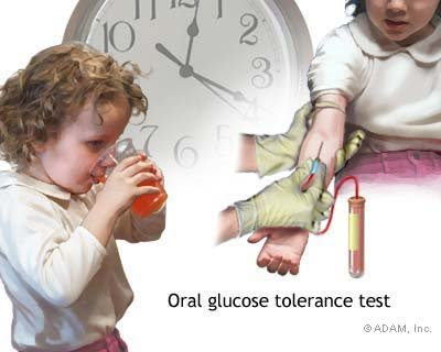 Oral Glucose Tolerance Test Procedure 85