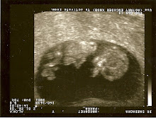 Baby 12 Weeks