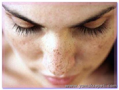 [ciltbakimi_00002.jpg]