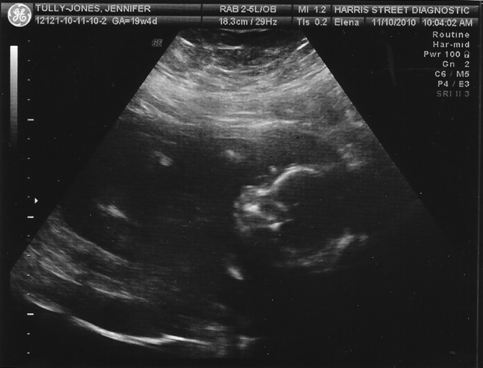 My perfect family of four! 20 Week Ultrasound Photos
