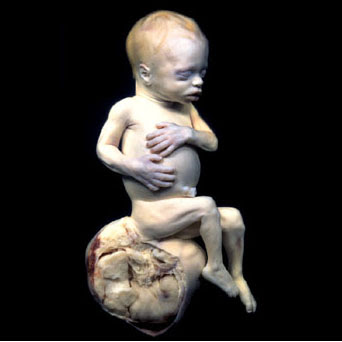 Anecdotario del Rock. Las anécdotas y curiosidades más absurdas de la  historia del rock: Un feto muerto en una portada de un disco de Rammstein