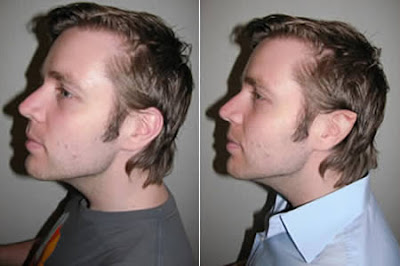 WEIRD NEWS: 8 Most Awful and Bizarre Body Modifications
