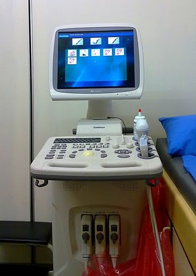 4D ultrasound machine