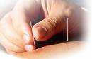 Acupuncture is thousands of years old