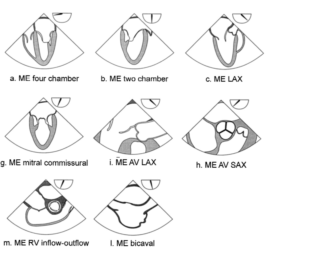 Nuclear cardiology transesophageal echo