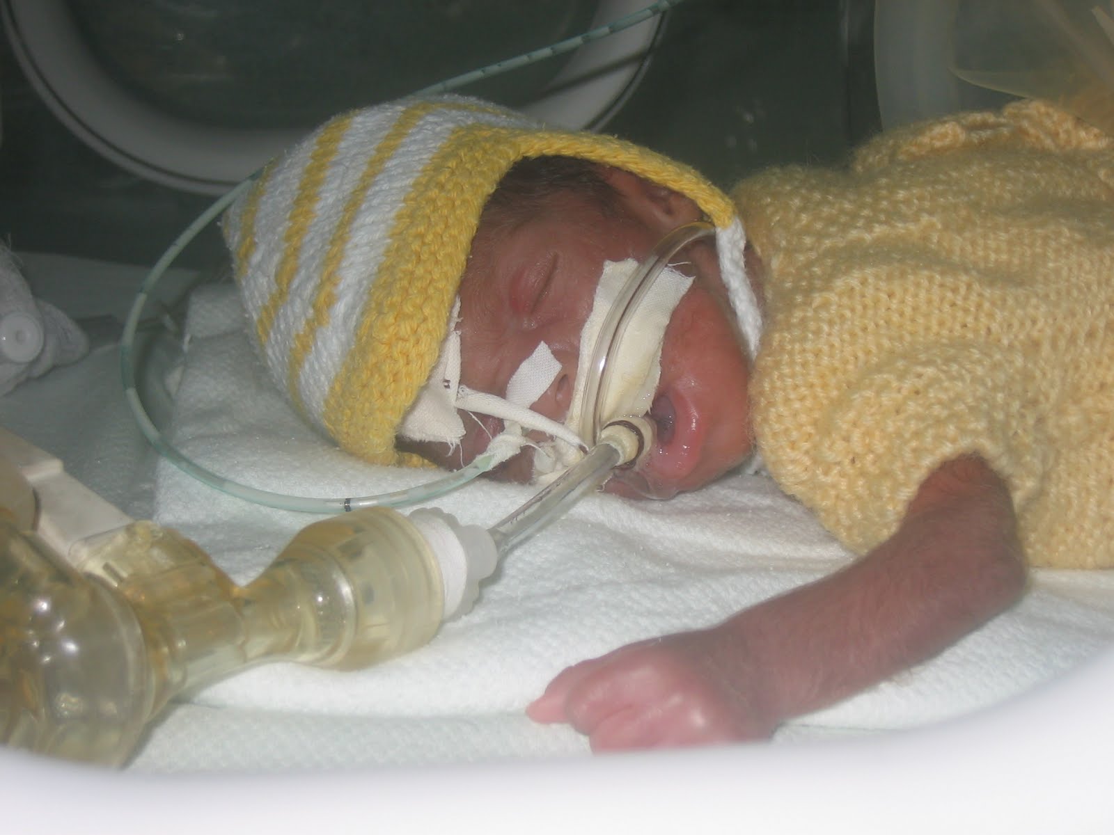 Strikkoman Nasal CPAP