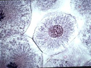 Профаза митоза лука. Профаза микрофотография. Фазы митоза под микроскопом. Интерфаза в микроскопе. Интерфаза в микроскопе.