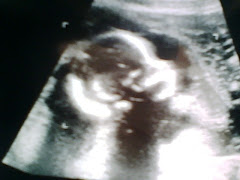Sonogram 19 weeks