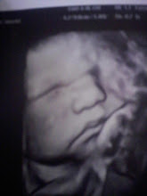 My 7th grand-daughter's 3-D ultra sound picture...