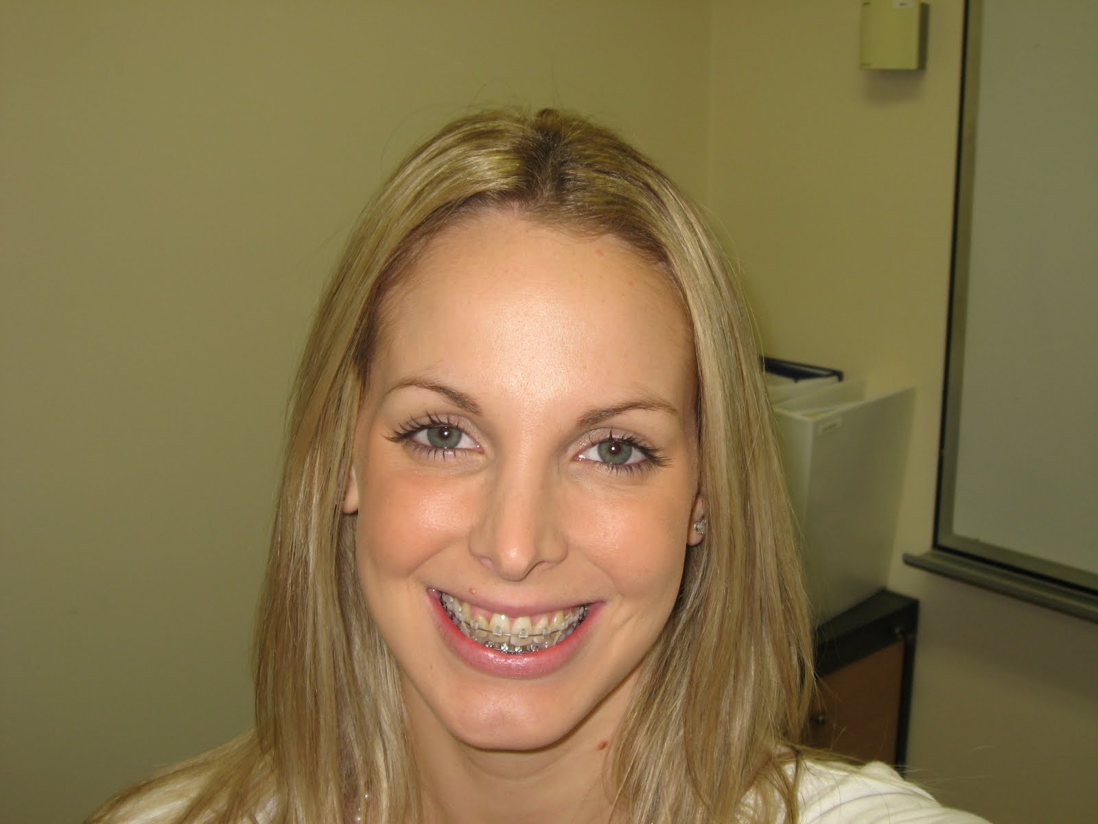 Surgery and braces what a treat...