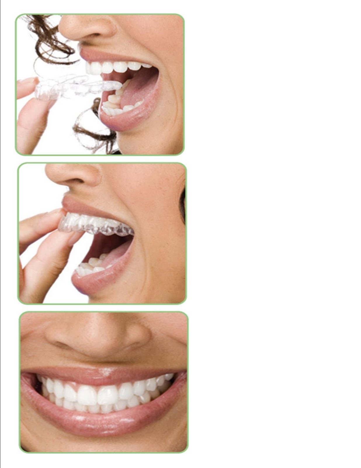 West Covina Smiles Dr Oscar Marin Clear Correct The Invisable Braces West Covina Smiles Dr Oscar Marin Clear Correct The Invisable Braces