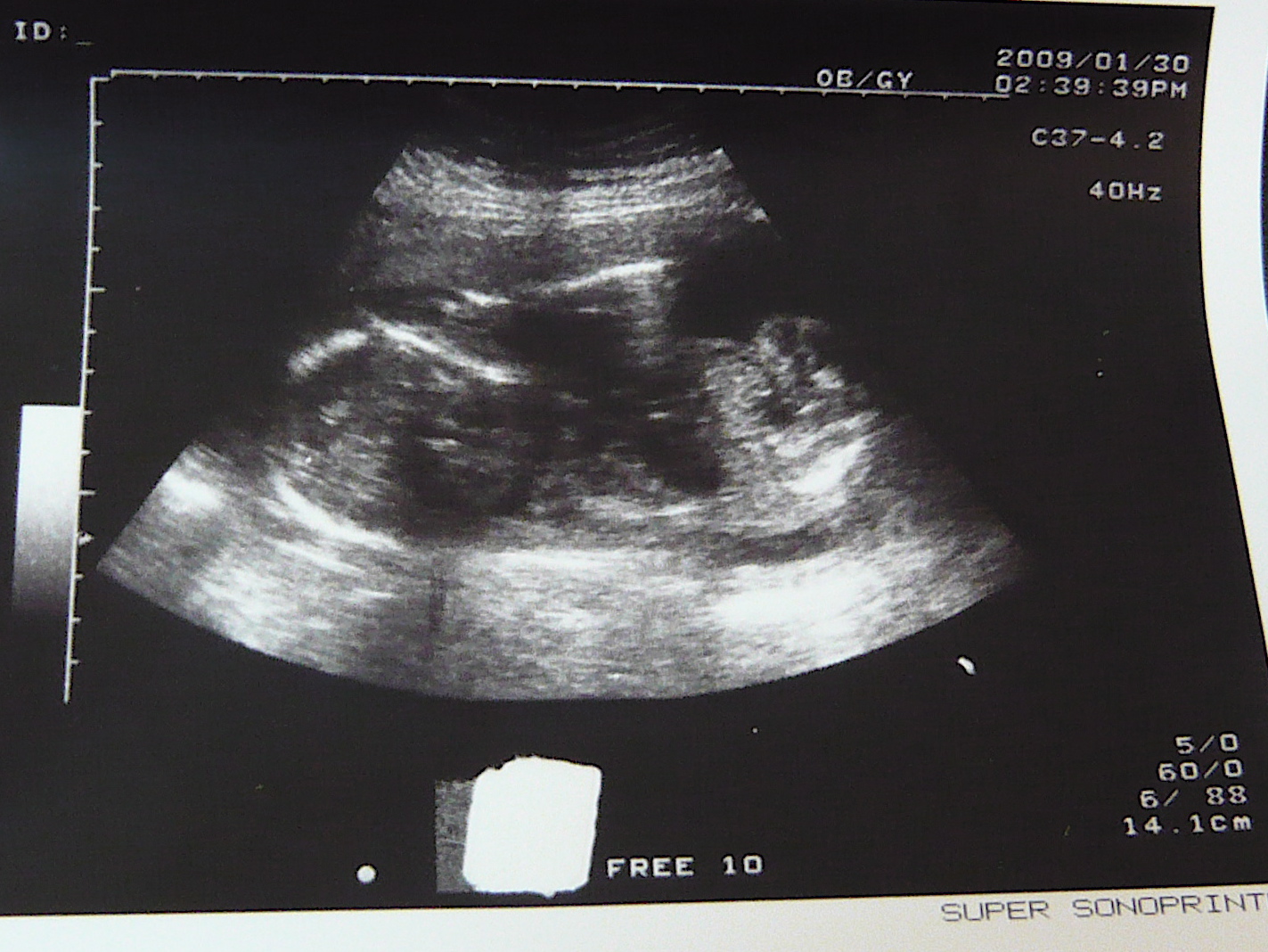 [P1000602.JPG]